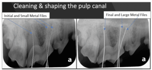 xrays of dog tooth