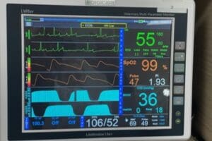 monitoring vital signs of pet under anesthesia for safety