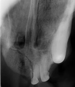 vet dentistry radiograph